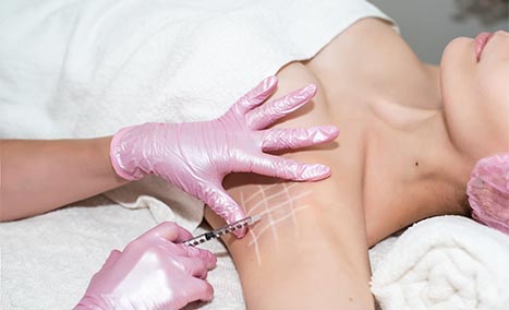 Excessive Underarm Sweating Injections